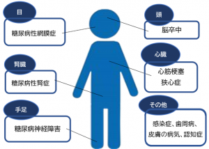 糖尿病合併症
